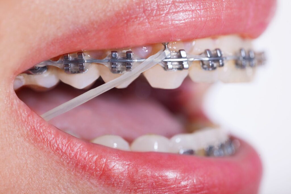 Can you eat with Rubber Bands